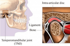 temporomandibular-disorder-ventura
