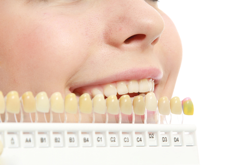 Why Your Teeth Changed Colors Over The Years | Ventura Total Dentistry