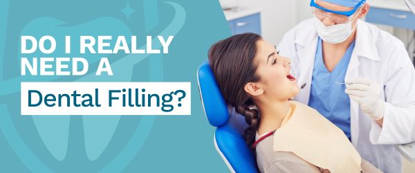 do-i-really-need-a-dental-filling do i really need a dental filling